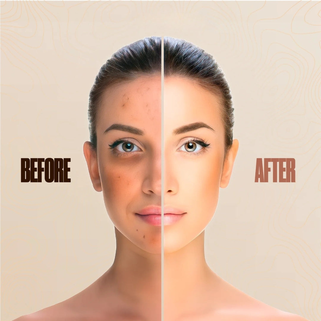 Vermoni® Serum Boosted Skin Tint Balm